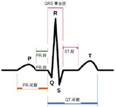 ?????е? P-QRS-T??