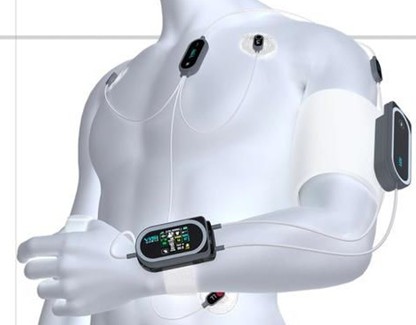 Sotera Wireless?????Visi Mobile????????????