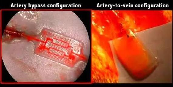 ?????????о?AngioChip???????????????????