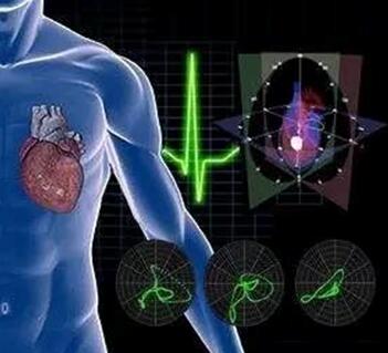 ?????????????4D-ECG??