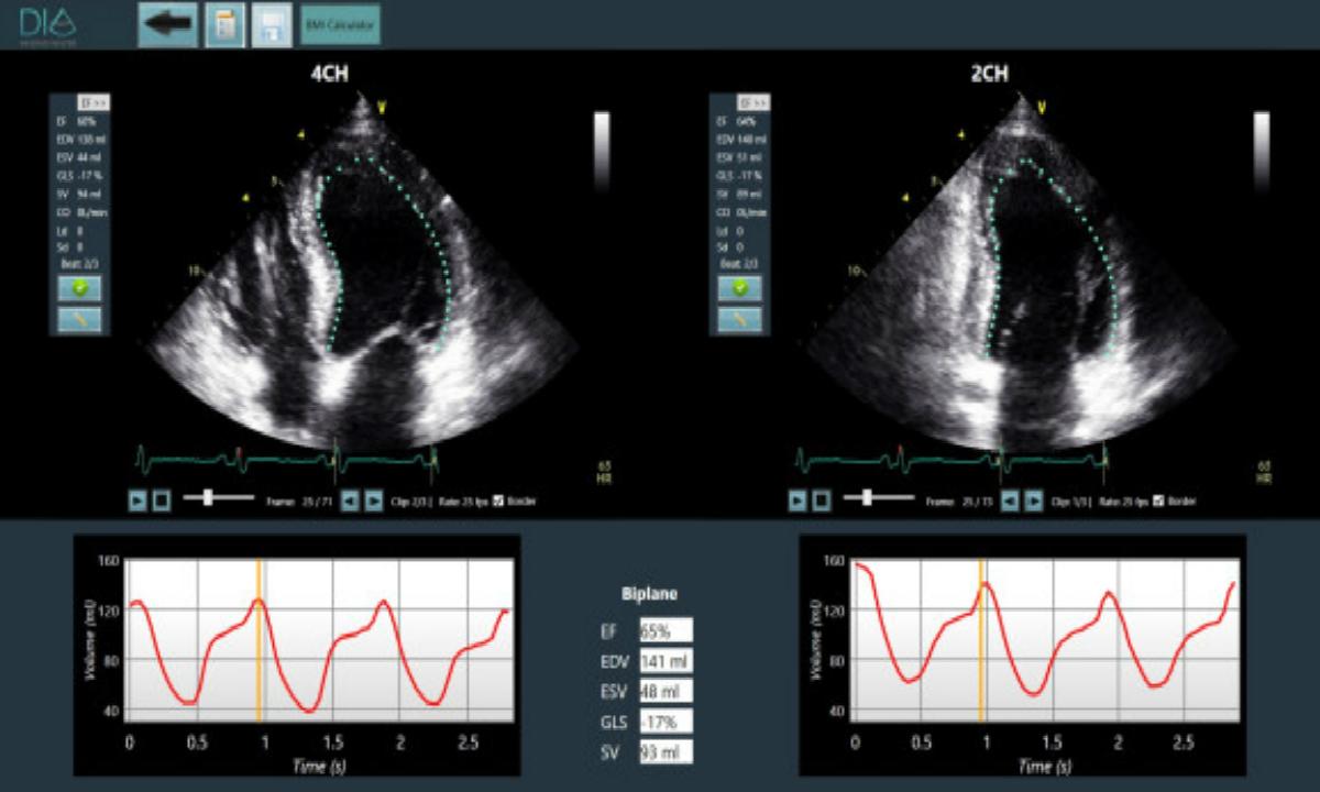 Dia Imaging Analysis???A???????????AI???????????輼??