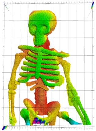 LiDAR?????????????100?????α???3D????