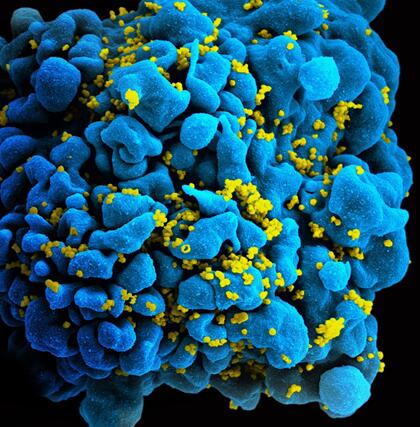 ???HIV??T??????羵?