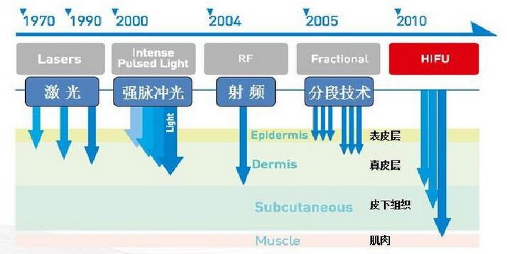 ?????????????High-Intensity Focused Ultrasound?????HIFU??