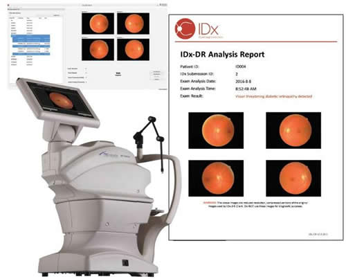 IDx????????????