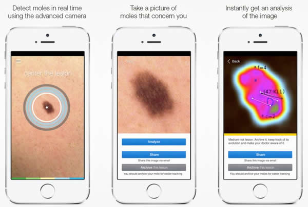 SkinVision??????????????????????????APP