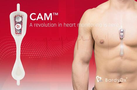 BardyDx????????????????????ECG??CAM???
