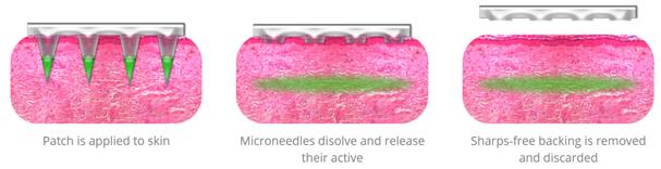 Micron Biomedical???????????????????????????