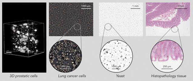 ????????????> 100µm?????????> 5µm??????????1µm????????????