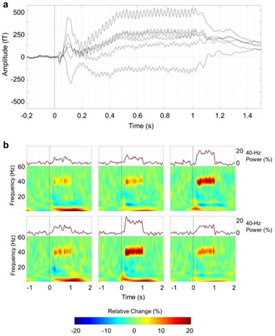 40Hz??????????????????????κ?????????TFR??