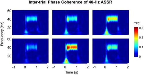 40Hz ASSR??μ???λ??????ITPC?????
