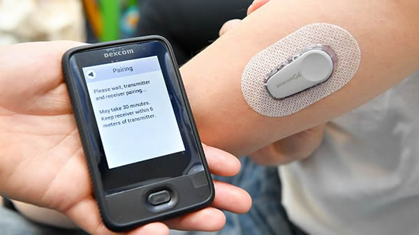 Dexcom???????????