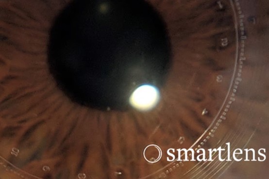 ??????????????????????????Smartlens???A??????