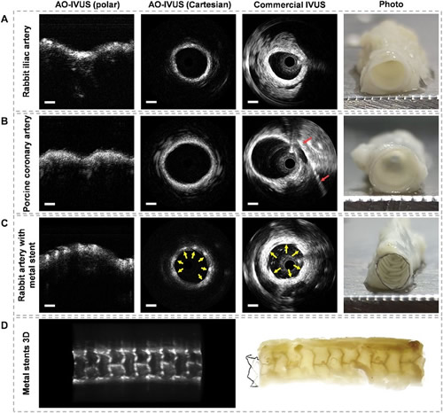 ???AO-IVUS??????IVUS?????????????